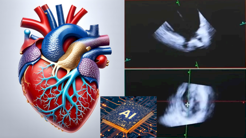 El Hospital público Ramón y Cajal usa la ecografía en 4D de forma pionera para hacer cirugías sin corazón abierto