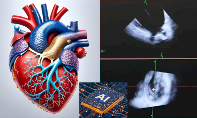 El Hospital público Ramón y Cajal usa la ecografía en 4D de forma pionera para hacer cirugías sin corazón abierto